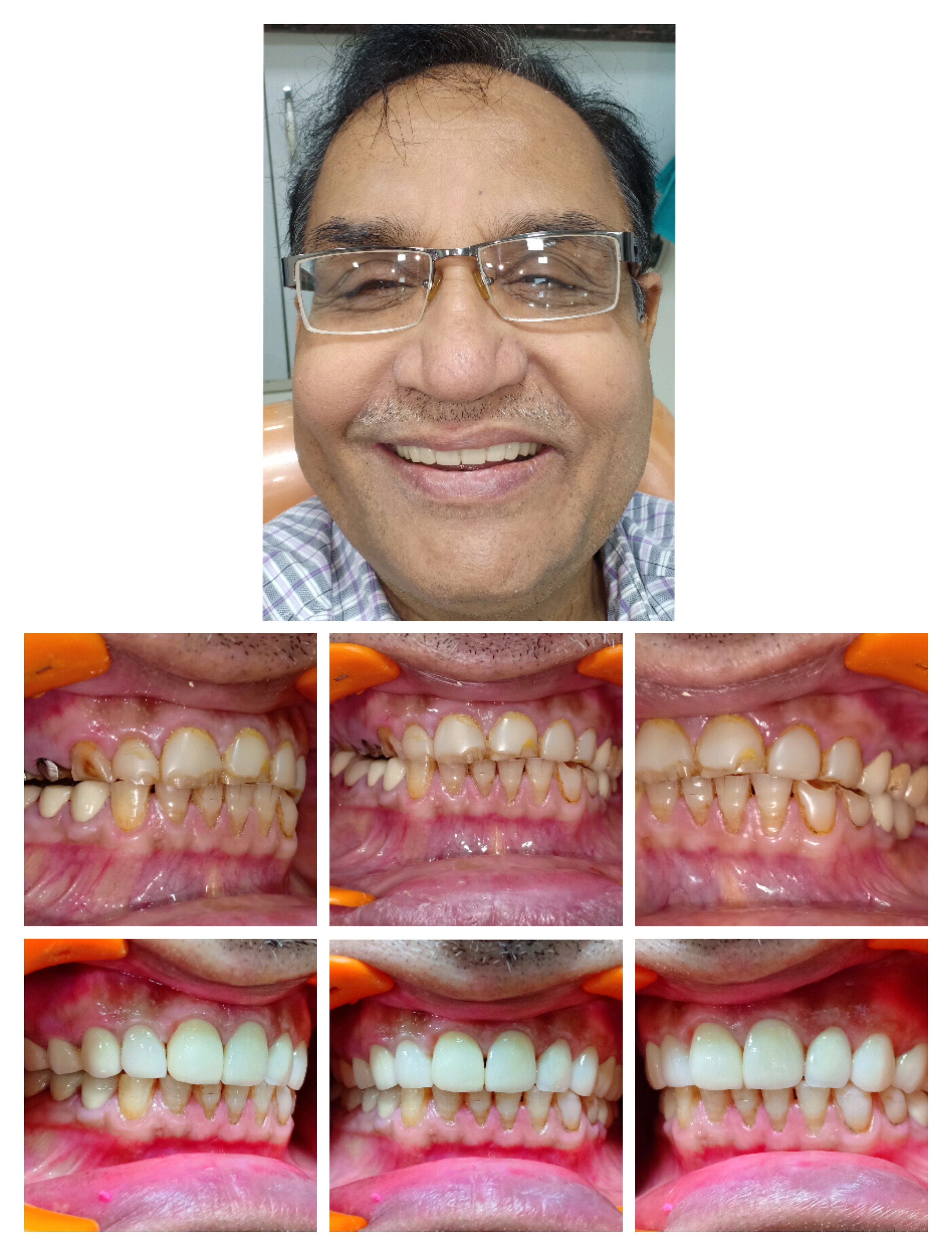 Dental Care &amp; Implant Clinic - Dr. Manish Guri - Tooth n ...